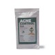 Acne Control – Máscara Secativa